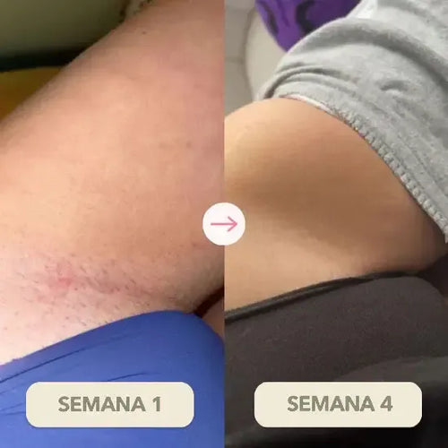 Semana 1-3